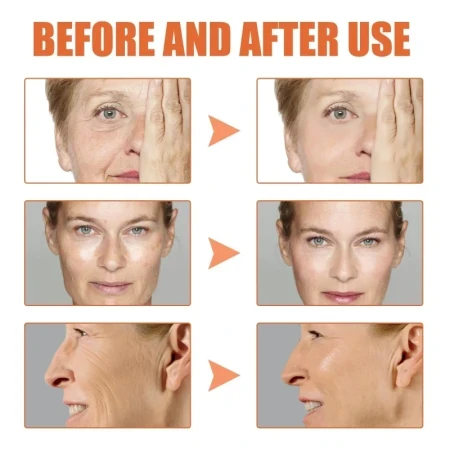 First slide