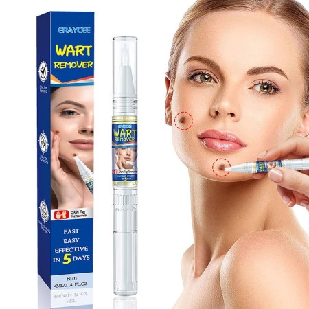 Wart Removing Pen