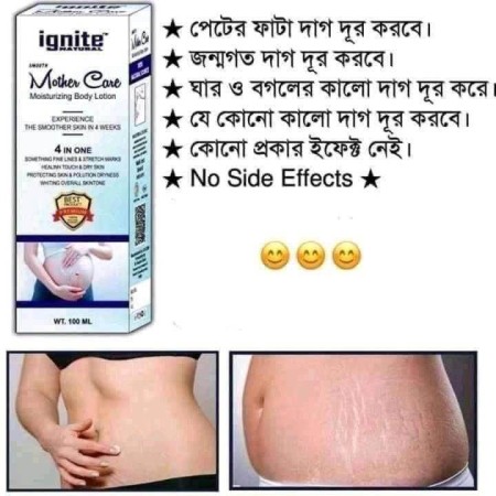 Ignite Mother Care Lotion