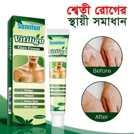 Sumifun Vitiligo Care Cream